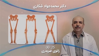 همه چیز در مورد زانوهای ضربدری