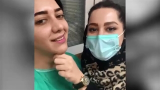 بلافاصله بعد از لیپوساکشن غبغب بدون درد توسط دکتر امید ابراهیمی