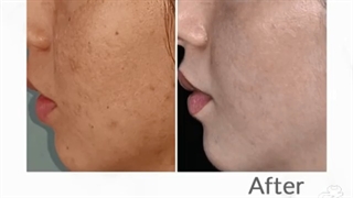 فیلم آر اف صورت