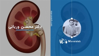 پاسخ سوالات شما در رابطه با سنگ کلیه