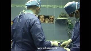 تزریق فیلر بینی (ویدیو کامل از جراحی)