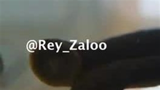 زالوی طبی جایگزینی در علم پزشکی نوین ندارد.