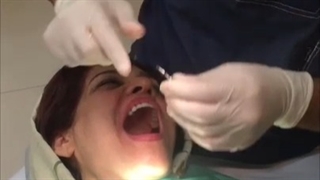 کاشت ایمپلنت فوری به روش فرش ساکت (بلافاصله پس از کشیدن دندان)