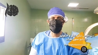 عمل جراحی تنگی کانال و اسکولیوز دژنراتیو ستون فقرات