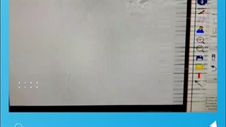 درمان پارگی یکی از عروق شکم با روش اندوواسکولار