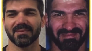 اصلاح نواقص بینی