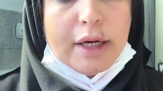 نکات مهم سمعک