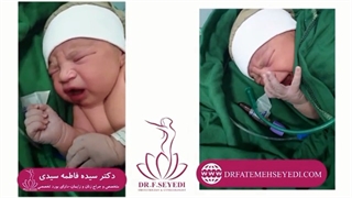 زایمان طبیعی