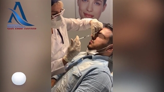 فیلم تزریق فیلر به بینى