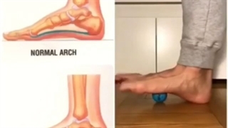 حرکات اصلاحی و توانبخشی کف پای صاف