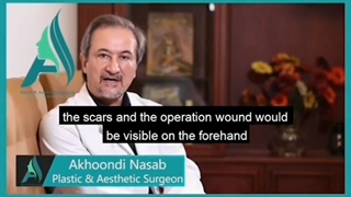 disadvantage of phalloplasty of forearm