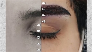 نمونه ای دیگر از کاشت ابرو