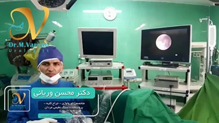 عمل سنگ شکن سنگ حالب