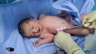 فیلم کامل و بدون سانسور زایمان سزارین