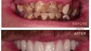 زیبایی دندان