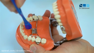 پیچ سقف دهان یا پیچ کام (هایرکس)