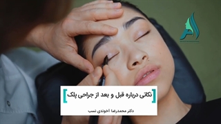 نکات مهم قبل و بعد از جراحی پلک برداشتن خال گوشتی
