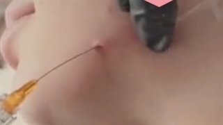 زاویه سازی صورت در تهران توسط دکتر علیزاده جراحی گوش