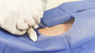 تزریق بوتاکس دندانپزشک زیبایی