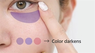 سیاهی زیر چشم شما از چه نوعیه؟