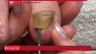 آموزش پدیکور و مانیکور|آموزش پدیکور|کاشت ناخن پا (پدیکور گل رز)