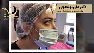 فیلم جراحی لیفت دایرکت ابرو