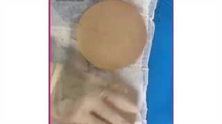 حرکت ژل صورت به غده لنفاوی!!