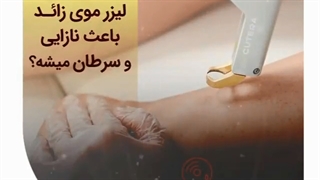 لیزر موهای زائد باعث نازایی و سرطان میشود؟