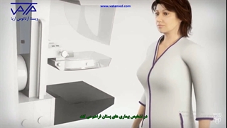 روش انجام ماموگرافی در تشخیص سرطان پستان