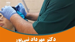 لیفت ابرو با نخ