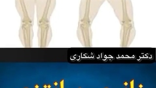 زانوی پرانتزی چیست و درمان آن چگونه است؟