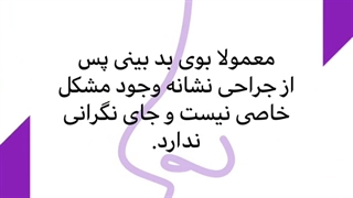 چرا بعد عمل بینی، بوی بدی را حس می کنم؟