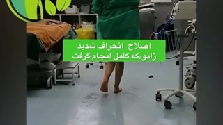قبل و بعد از عمل اصلاح انحراف شدید زانو