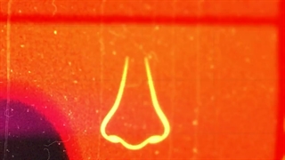 جراحی زیبایی بینی گوشتی