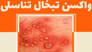 واکسن تبخال تناسلی