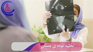 تخلیه توده سرطانی