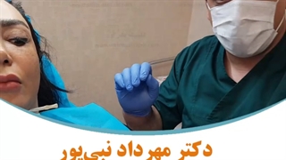 چربی سوزی غبغب با نخ