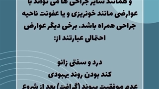 خطرات بازسازی رباط صلیبی