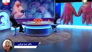 درماتیت تماسی در کودکان