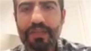 دکتر امیر اشرفی بررسی لک صورت