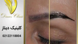 فیلم کاشت ابروی طبیعی