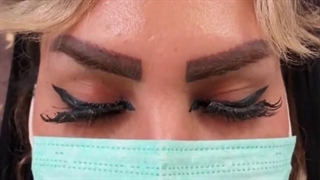 فیلم قبل و بعد کاشت ابرو