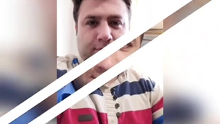 فیلم واقعی و بدون سانسور کاشت مو