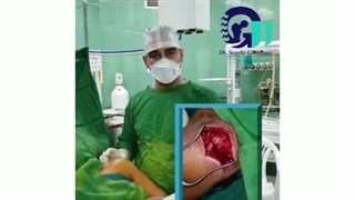 درمان پارگی رباط  بر اثر سقوط از ارتفاع در آقای 30 ساله