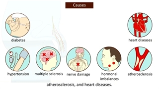 ناتوانی جنسی