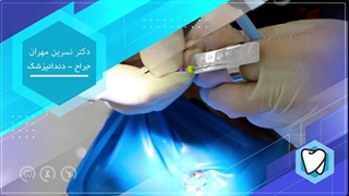 دکتر نسرین مهران لمینت