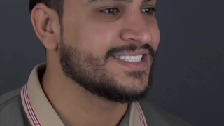 کامپوزیت ونیر در کلینیک بارانا