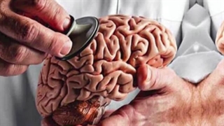 سکته مغزی چیست و علت و علائم سکته مغزی چیست؟