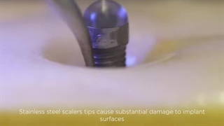 جرم گیری ایمپلنت دندان - مراقبت های بعد از ایمپلنت