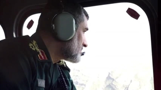 شهید امیرعلی حاجی زاده ترمیم زیبایی دندان